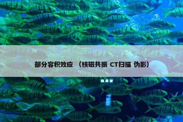 部分容积效应 （核磁共振 CT扫描 伪影）